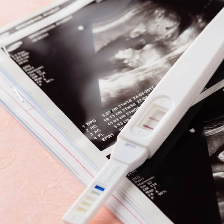 Pregnancy test and ultrasound picture.